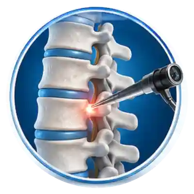 Endoscopic Spine Surgery
