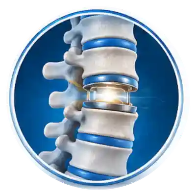 Motion-Preserving Spine Surgery